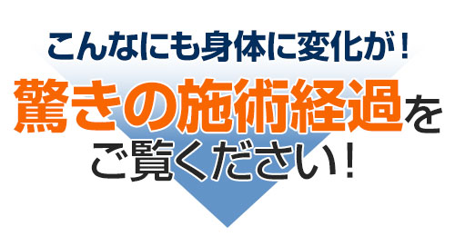 こんなにも身体に変化が！驚きの施術経過をご覧ください！