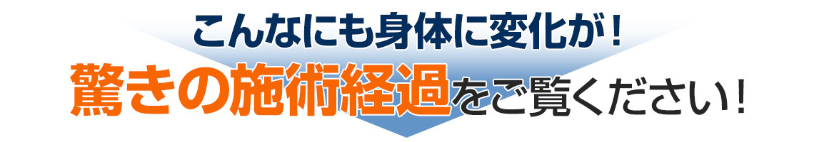 こんなにも身体に変化が！驚きの施術経過をご覧ください！