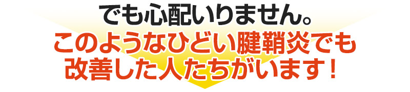 でも心配いりません。 このようなひどい腱鞘炎でも改善した人たちがいます！